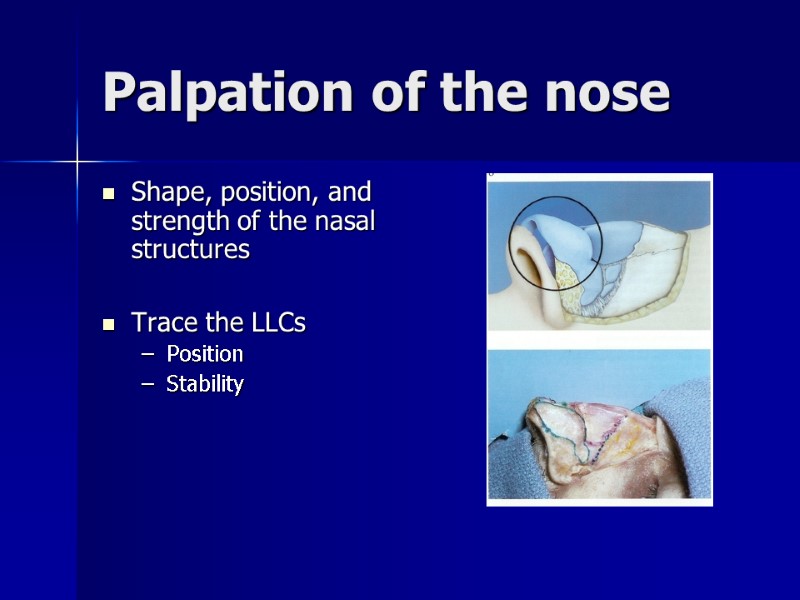 Palpation of the nose Shape, position, and strength of the nasal structures  